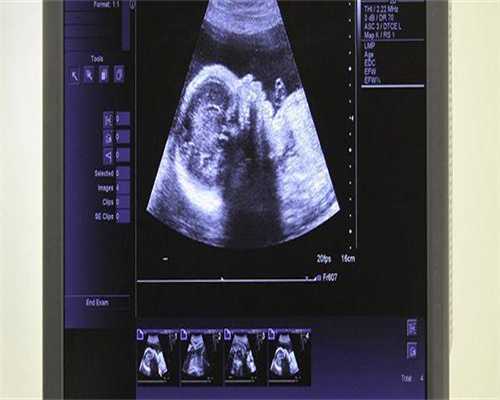 供卵代生儿子有补贴吗,女方有幼稚子宫，在黑龙江安达当地能做试管婴儿吗？