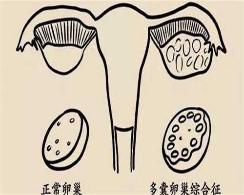 甘肃可以借卵吗供卵医院成功率靠谱代生电话