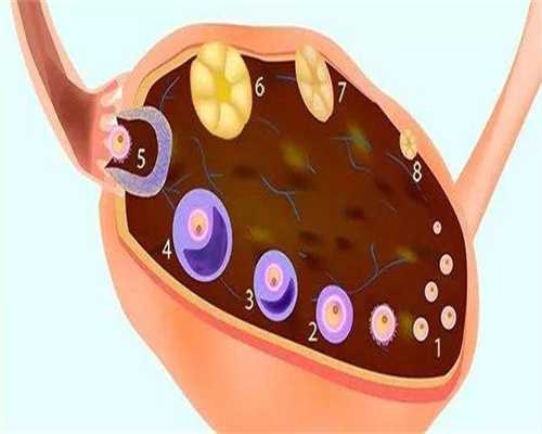 子宫有息肉影响做试管吗,子宫息肉影响做试管婴儿吗