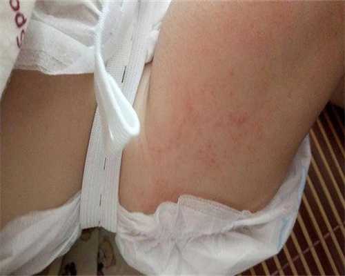 供卵价钱表-沈阳哪家医院做三代试管婴儿的技术最好，沈阳三代试管口碑颐源居推荐附试管详细流程