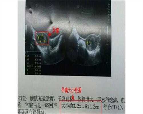 子宫内膜薄做试管如何调理-子宫内膜薄能做试管么