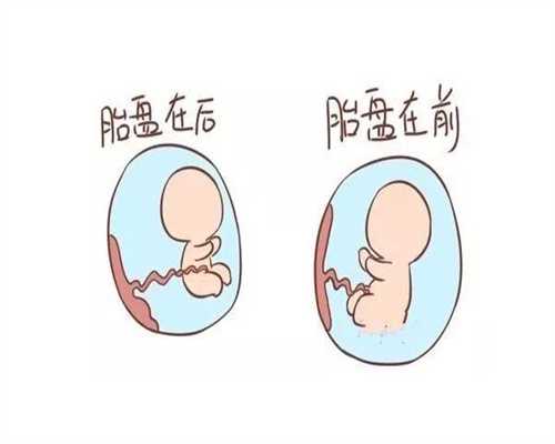 腺肌瘤试管婴儿初诊多少钱 子宫腺肌瘤做试管婴儿长方案