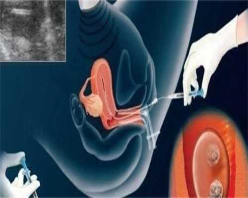 沈阳试管助孕代怀代生费（试管助孕代怀代生费）_5沈阳30万代生