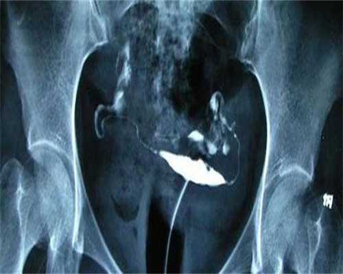 沈阳第三代私立借卵试管助孕代怀技术沈阳代怀招聘